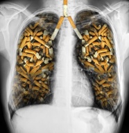 吸烟者的肺图片